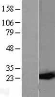 GST3 (GSTP1) Human Over-expression Lysates NM_000852