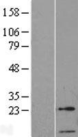 TFIIA2 (GTF2A2) Human Over-expression Lysates NM_004492