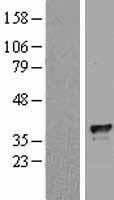 TFIIB (GTF2B) Human Over-expression Lysates NM_001514