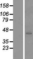 GTF2H2 Human Over-expression Lysates NM_001515