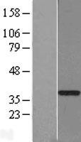 GTF2H3 Human Over-expression Lysates NM_001516