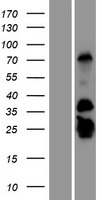 GCAP2 (GUCA1B) Human Over-expression Lysates NM_002098