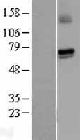 GUCY1A1 Human Over-expression Lysates NM_000856