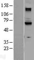 GUCY1B1 Human Over-expression Lysates NM_000857