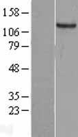 ls002984 gucy2c human over expression lysates nm 004963 wb testing 1