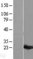 Guanylate kinase (GUK1) Human Over-expression Lysates NM_001159391
