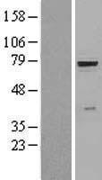 beta glucuronidase (GUSB) Human Over-expression Lysates NM_000181