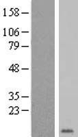 ls002996 gype human over expression lysates nm 198682 wb testing 2