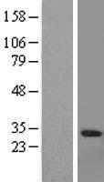 Granzyme A (GZMA) Human Over-expression Lysates NM_006144