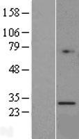 Granzyme K (GZMK) Human Over-expression Lysates NM_002104