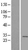 Histone H1