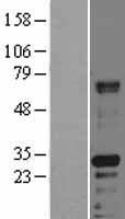 HABP2 Human Over-expression Lysates NM_004132