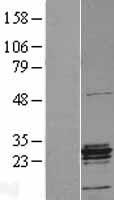 ERAB (HSD17B10) Human Over-expression Lysates NM_001037811