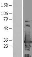 ERAB (HSD17B10) Human Over-expression Lysates NM_004493