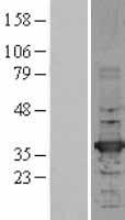 ls003033 hadhsc hadh human over expression lysates nm 005327 wb testing 2