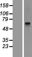 Histidase (HAL) Human Over-expression Lysates NM_002108