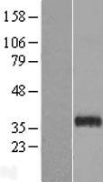 HAS3 Human Over-expression Lysates NM_138612