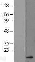 ls003040 hba2 human over expression lysates nm 000517 wb testing 1