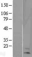 HBA-T2 (HBB) Human Over-expression Lysates NM_000518