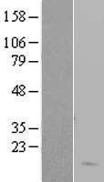ls003045 hemoglobin subunit delta hbd human over expression lysates nm 000519 wb testing 1