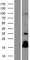 ls003049 hbq1 human over expression lysates nm 005331 wb testing 1