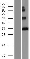 ls003052 hccs human over expression lysates nm 001122608 wb testing 1