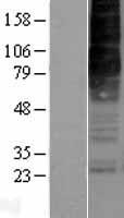 Orexin Receptor 2 (HCRTR2) Human Over-expression Lysates NM_001526