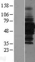 HDAC1 Human Over-expression Lysates NM_004964