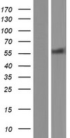 HDAC2 Human Over-expression Lysates NM_001527