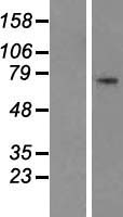 Histidine decarboxylase (HDC) Human Over-expression Lysates NM_002112