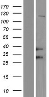 ls003077 hfe human over expression lysates nm 139006 wb testing 2