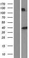 ls003077 hfe human over expression lysates nm 139009 wb testing 3