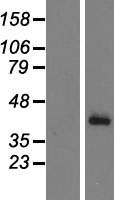 ls003078 cfhl1 cfhr1 human over expression lysates nm 002113 wb testing 1