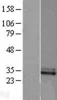 ls003080 cfhl2 cfhr2 human over expression lysates nm 005666 wb testing 1