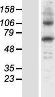 ls003081 hgd human over expression lysates nm 000187 wb testing 1