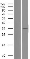 HGF Human Over-expression Lysates NM_001010931