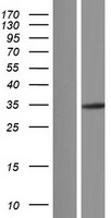 HGF Human Over-expression Lysates NM_001010933