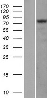 HIF-1 alpha (HIF1A) Human Over-expression Lysates NM_181054