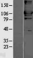 ls003099 hexokinase ii hk2 human over expression lysates nm 000189 wb testing 1