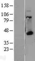 HLAA (HLA-A) Human Over-expression Lysates NM_002116