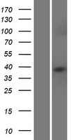 HLAC (HLA-C) Human Over-expression Lysates NM_002117