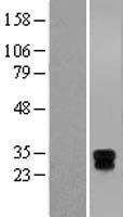 HLA DM (HLA-DMA) Human Over-expression Lysates NM_006120
