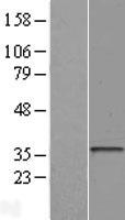 HLA-DOA Human Over-expression Lysates NM_002119