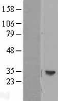 HLA DOB (HLA-DOB) Human Over-expression Lysates NM_002120