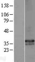 HLA DP (HLA-DPA1) Human Over-expression Lysates NM_033554