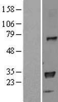 HLA-DPB1 Human Over-expression Lysates NM_002121