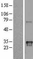 HLADQA1 (HLA-DQA1) Human Over-expression Lysates NM_002122