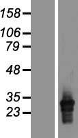 HLA-DQA2 Human Over-expression Lysates NM_020056