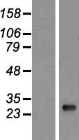 HLA-DQB1 Human Over-expression Lysates NM_002123