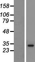 HLA-DRB5 Human Over-expression Lysates NM_002125